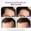 biotin-10000mcg-hair-growth-support-for-women-men--6.jpg