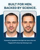 improved-complex-saw-palmetto-for-men-prostate-health-supplements-for-men---advanced-formula-saw-palmetto-extract-w-dhea-ashwagandha-900mg---dht-blocker-for-hair-support---prostate-supplements-7