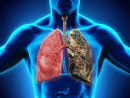 respiratory-formula---lung-cleanse-for-smokers---b-8.jpg