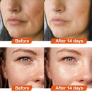 ultra-fine-vitamin-c-powder-cosmetic-grade-100g-pu-5.jpg
