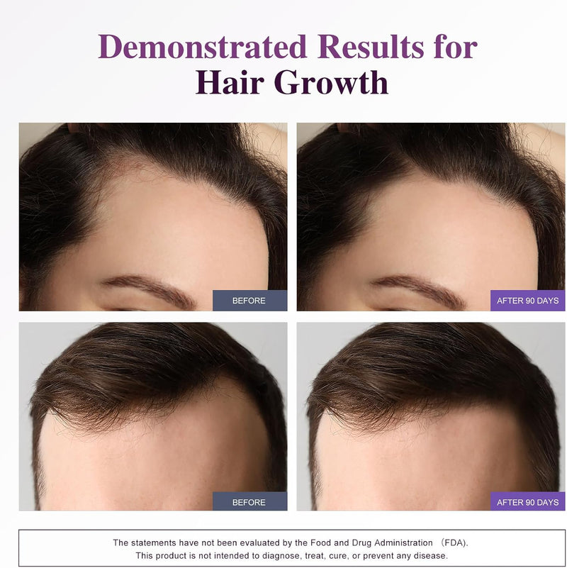 biotin-10000mcg-hair-growth-support-for-women-men--6.jpg