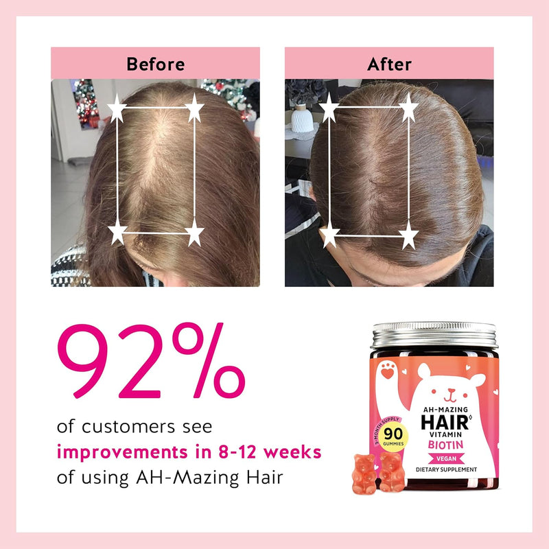 biotin-gummies-for-hair-skin-nails-5000-mcg-high-potency-vegan-vitamins-for-faster-hair-growth-stronger-nails-healthy-skin-with-vitamins-c-e-30-gummies-3