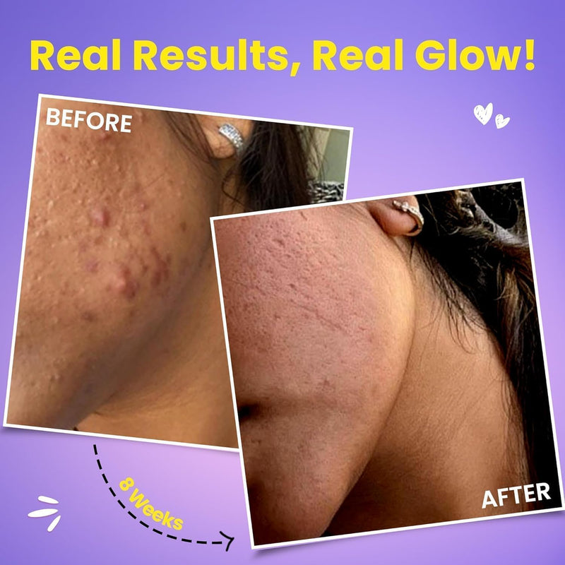 glow-glutathione-vit-c-skin-radiance-strawberry-le-2.jpg