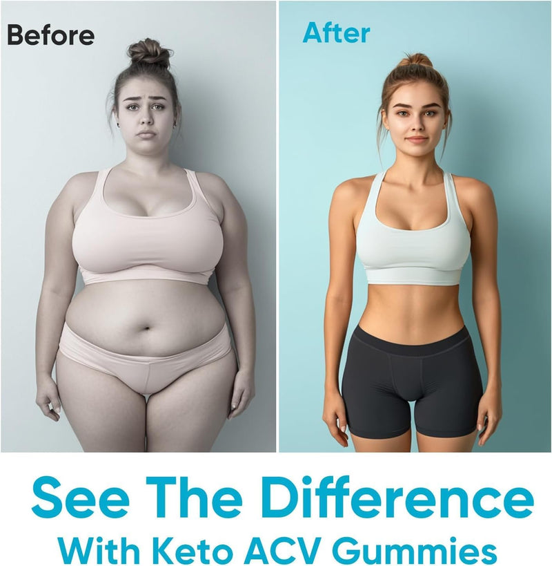 keto-acv-gu-mmies2000mg-apple-cider-vinegar-gummiesextra-b6-b12-folate-supportfor-women-and-men-weight-loss-60-gummies-5
